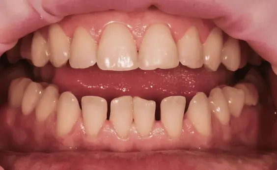 Портфолио - после 1