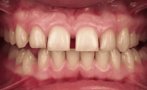 Портфолио - после 1