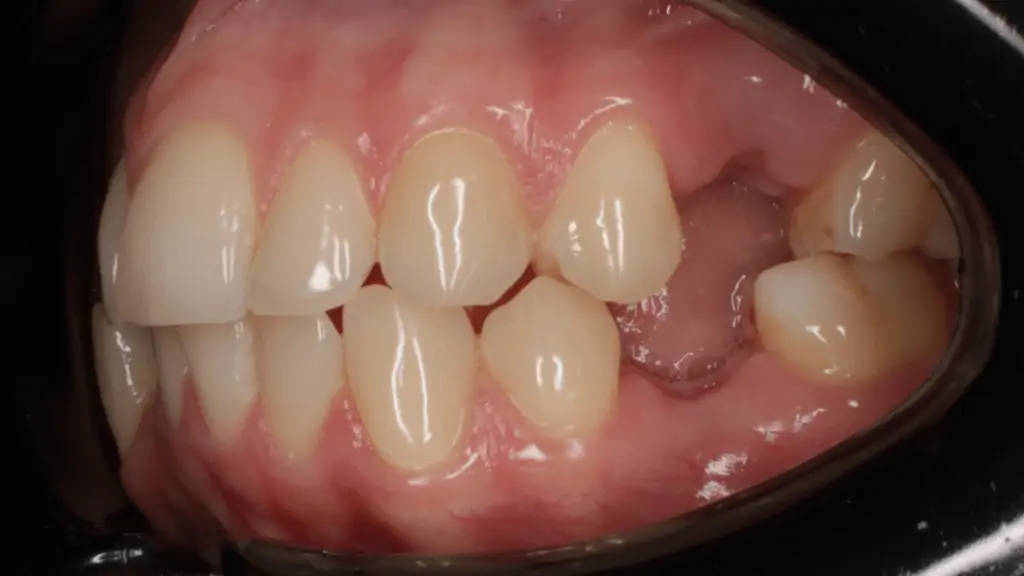 Портфолио - после 3