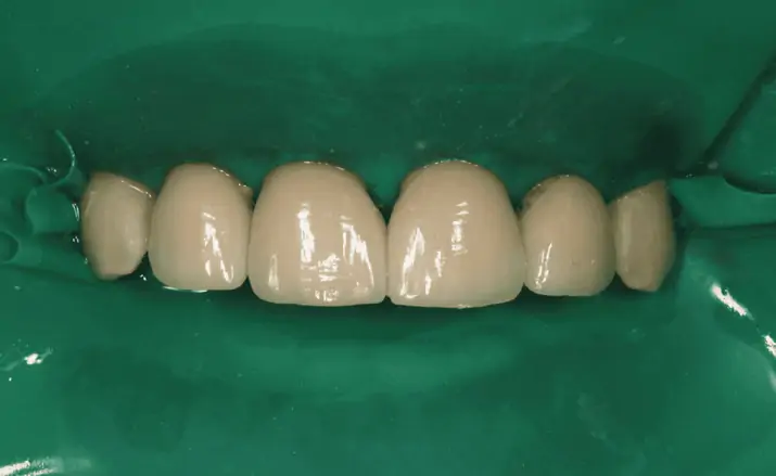 Портфолио - после 3