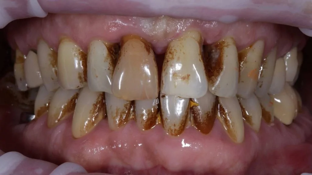 Портфолио - после 1