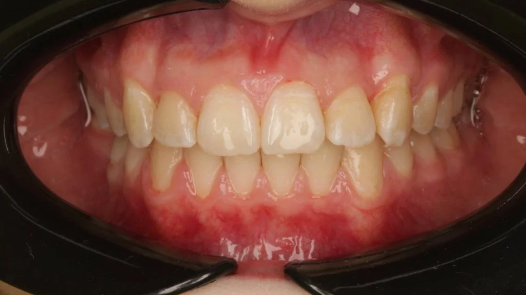 Портфолио - основное изображение