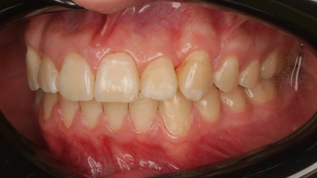 Портфолио - до 2