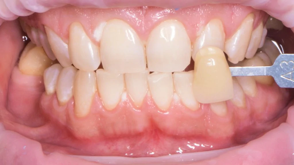 Портфолио - основное изображение