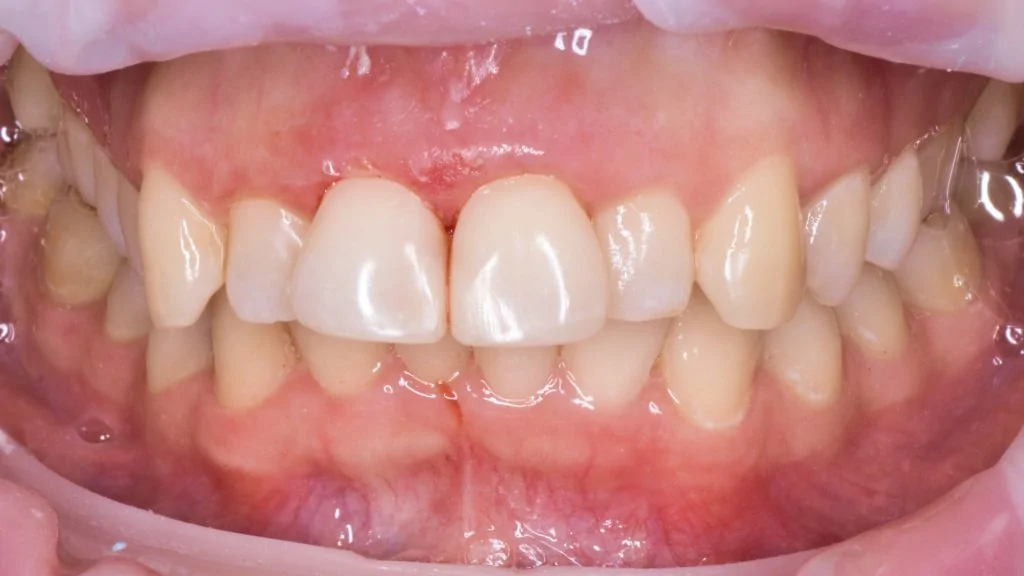 Портфолио - основное изображение