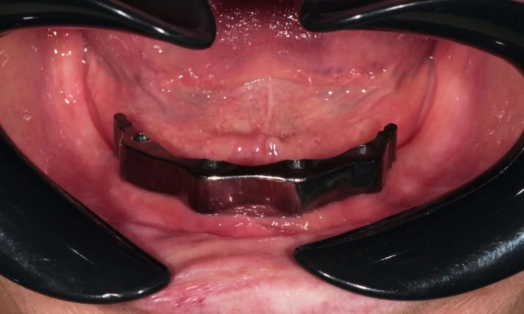 Портфолио - после 1