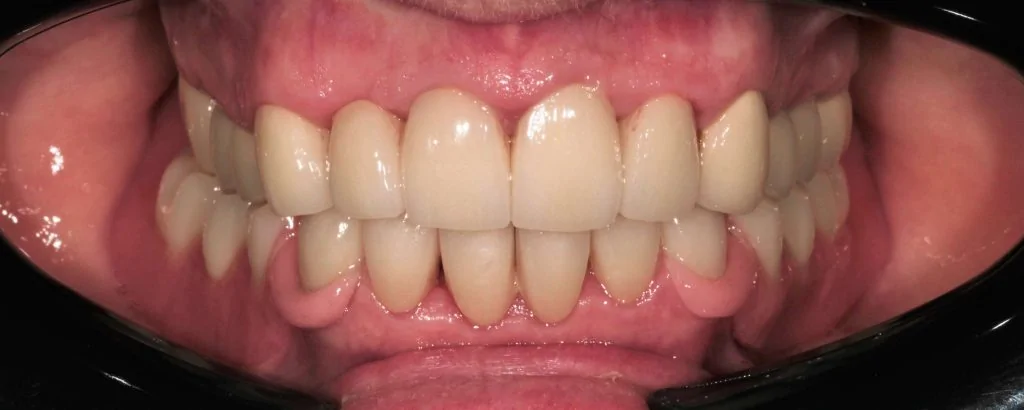 Портфолио - основное изображение