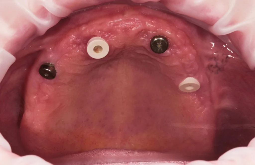 Портфолио - после 1