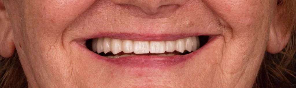 Портфолио - после 4