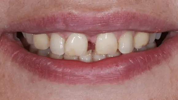 Портфолио - после 1