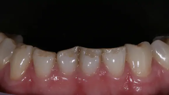 Портфолио - после 3