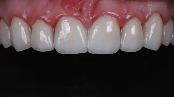 Портфолио - до 2