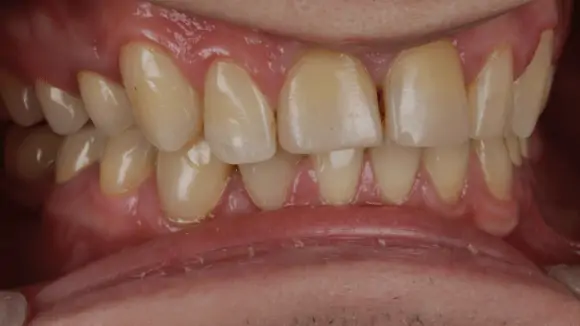 Портфолио - после 4