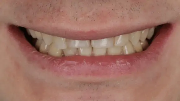 Портфолио - после 3