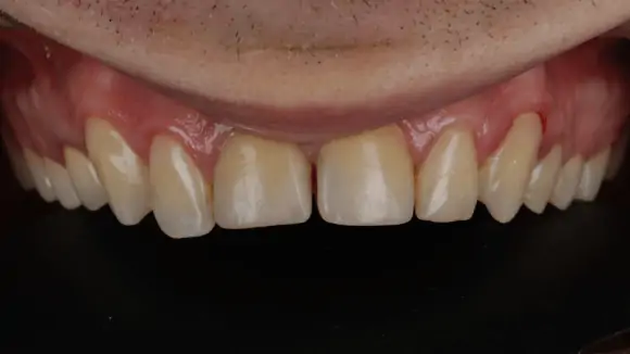 Портфолио - после 2