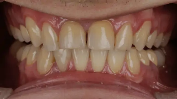 Портфолио - после 1