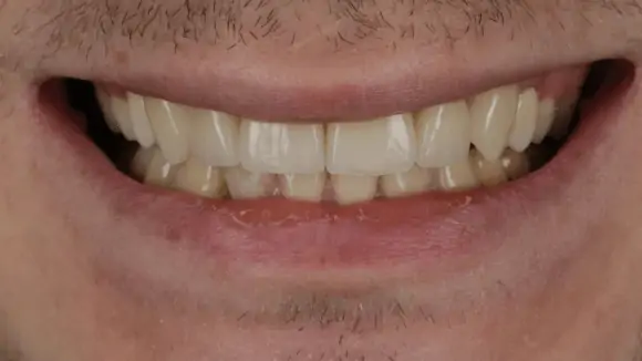 Портфолио - до 3