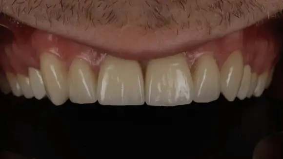 Портфолио - до 2