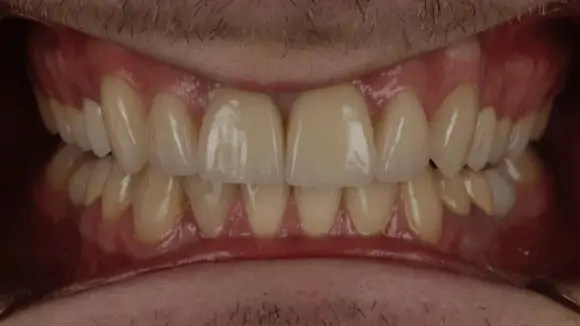 Портфолио - основное изображение