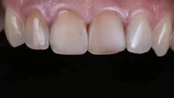 Портфолио - после 1