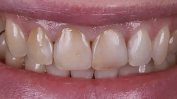 Портфолио - после 3