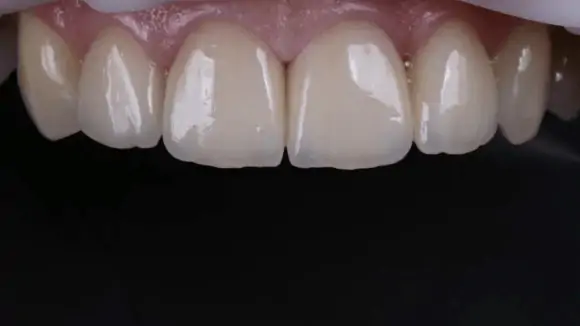 Портфолио - основное изображение