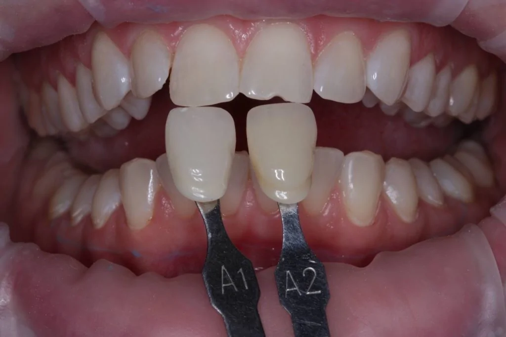 Портфолио - основное изображение