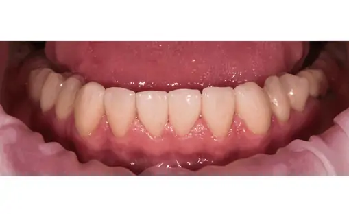 Портфолио - до 2