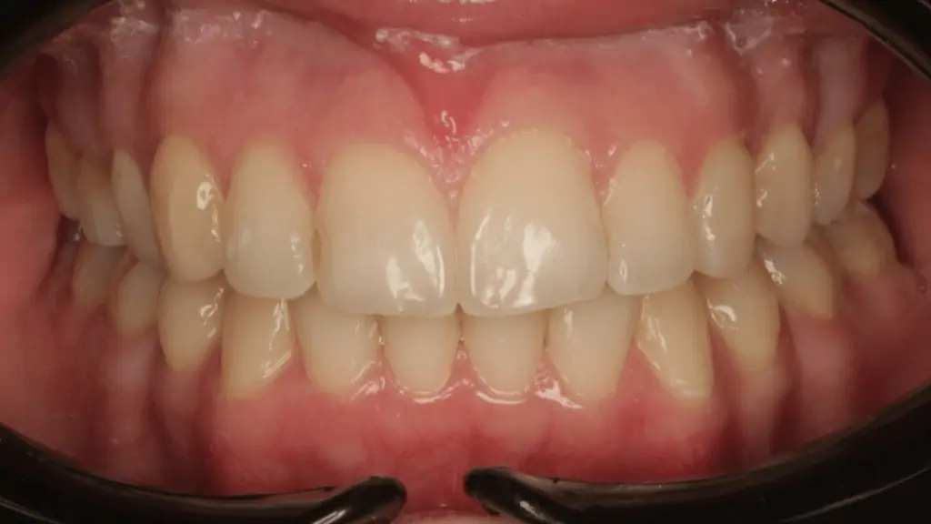 Портфолио - основное изображение