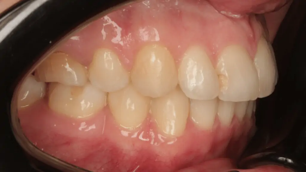 Портфолио - до 2