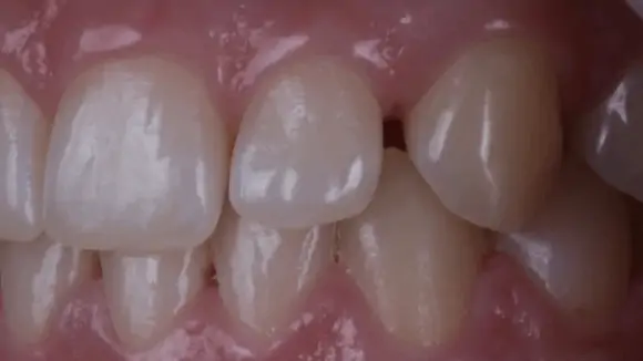 Портфолио - после 4