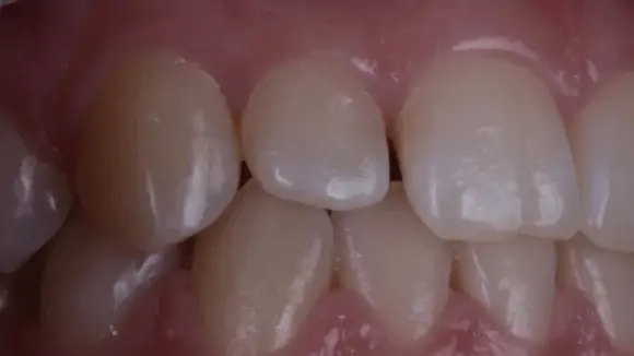 Портфолио - после 3