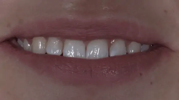 Портфолио - после 2