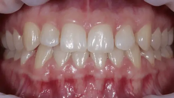 Портфолио - после 1