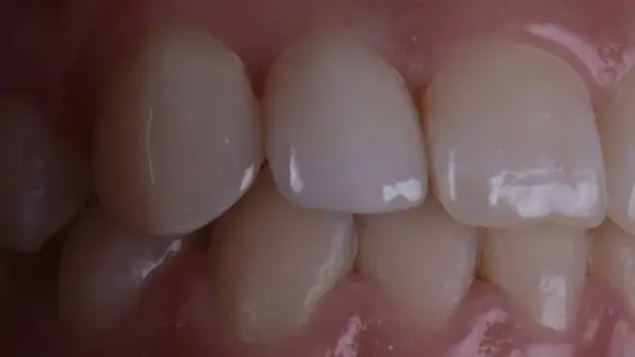 Портфолио - до 3