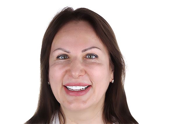 Протезирование на имплантах