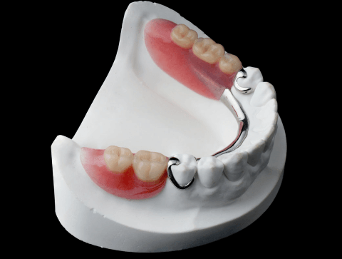 Бюгельные протезы