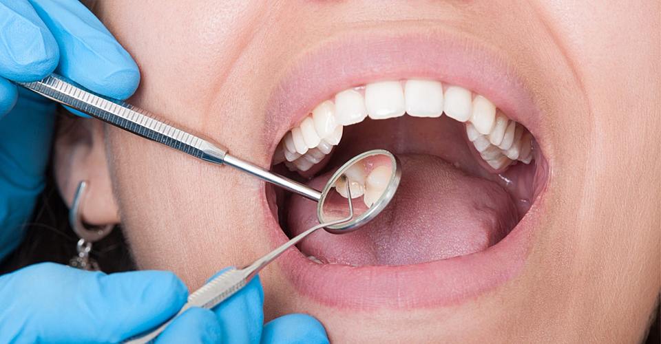 проверка на кариес зубов