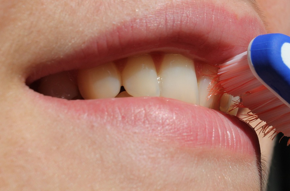 Как ухаживать за зубами после имплантации?